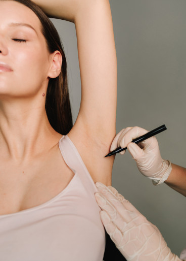 Eine junge Frau mit dunklem Haar hebt ihren linken Arm, damit der Arzt die Stelle markieren kann, die behandelt werden soll.